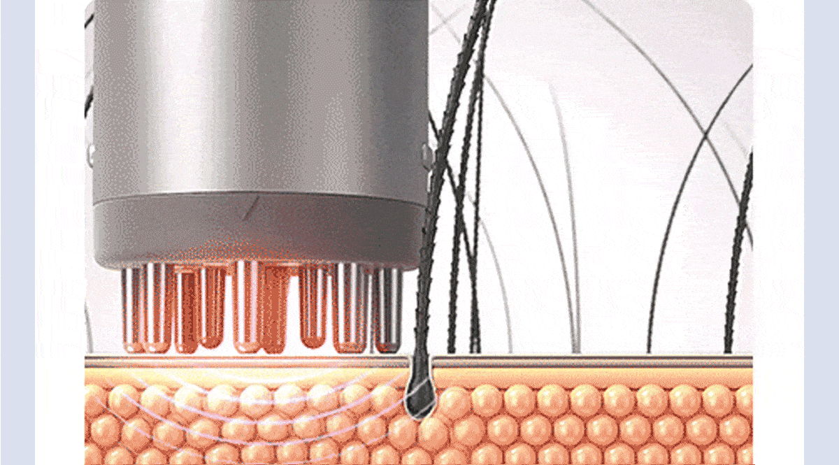 69e8e10a7715c17f1a6052679ae74402_1743688376_1469.gif