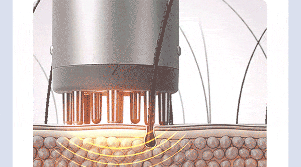 69e8e10a7715c17f1a6052679ae74402_1743688377_1683.gif